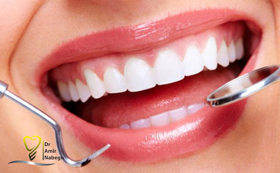 ترمیم های زیبایی دندان