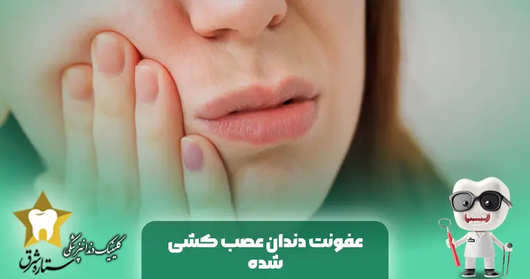 كيفية علاج عدوى الأسنان المعتلة؟