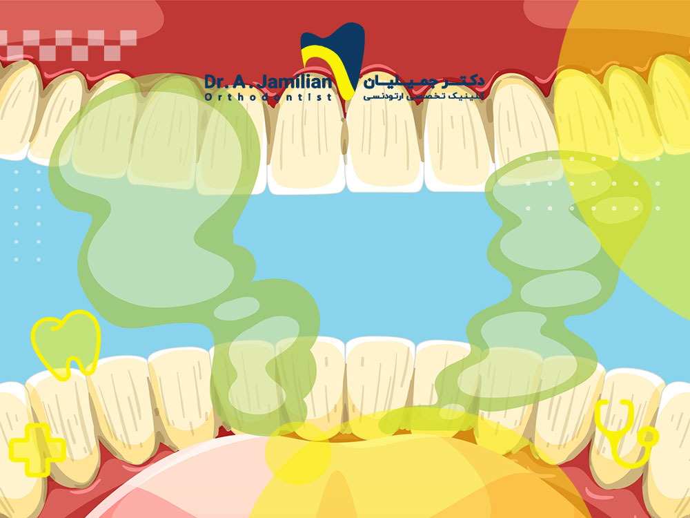 Eliminate the bad smell of a broken tooth in a week; Urgent and scientific solutions - Dr. Jamilian