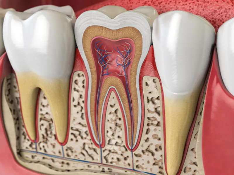 What is root canal surgery? Zero percent + 1404 cost