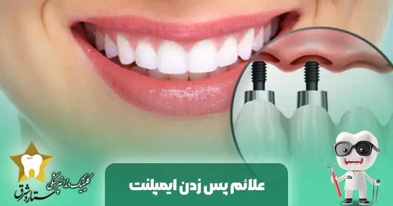 أعراض رفض زراعة الأسنان: دليل شامل للتشخيص والعلاج