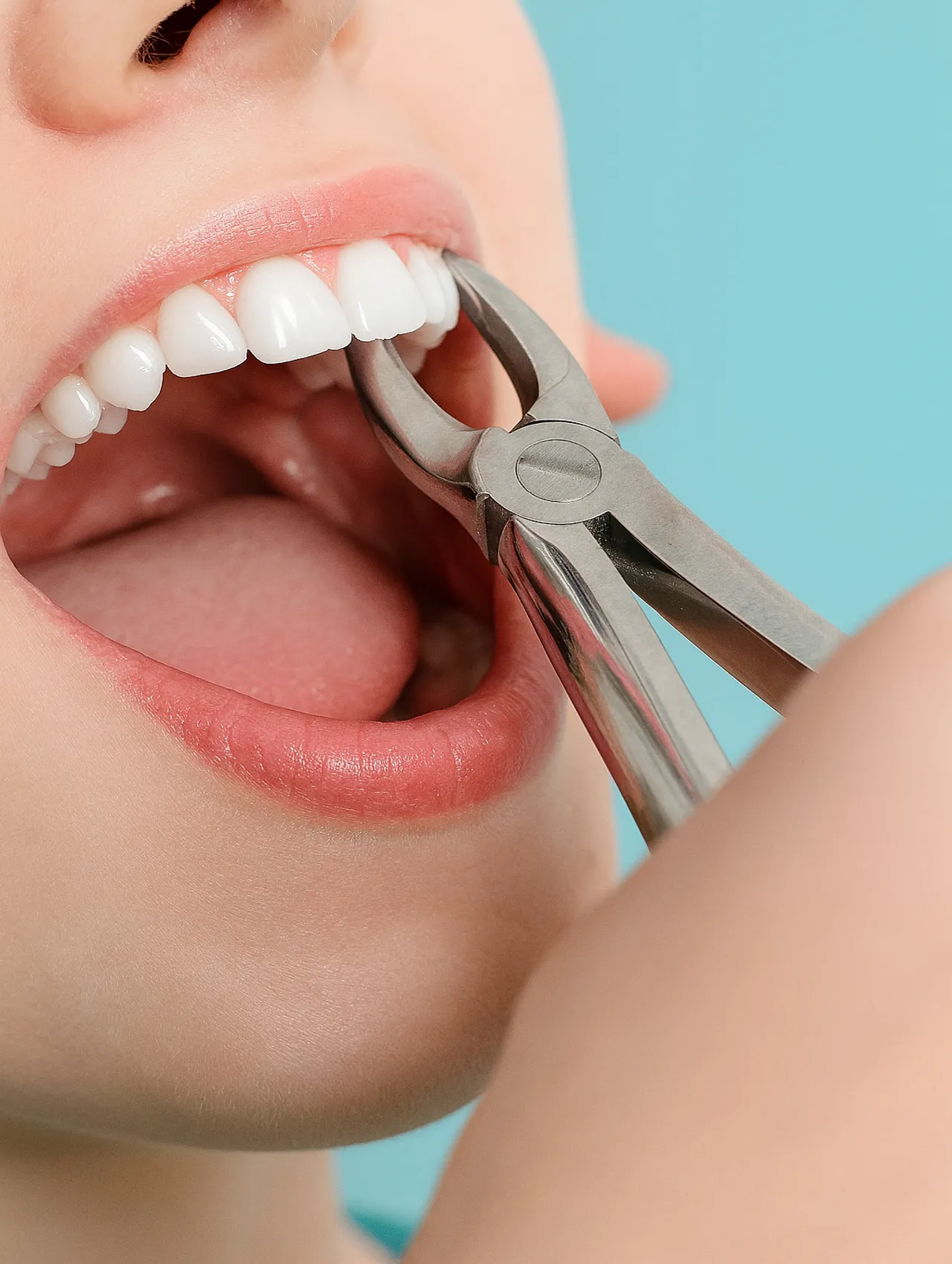The price of tooth extraction
