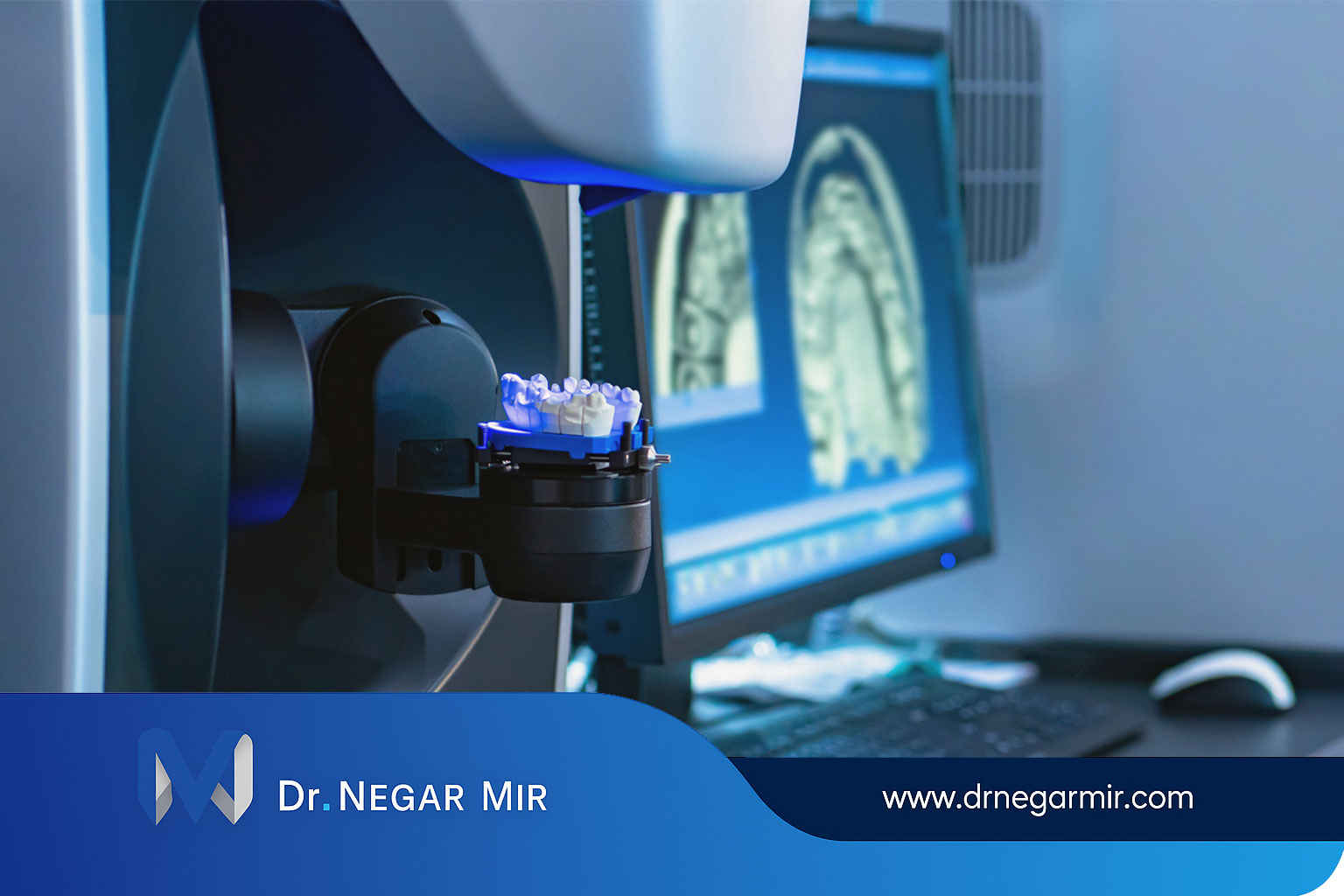 Digital implant is a new method in digital dentistry in Tehran 2025
