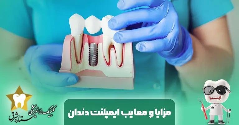 إيجابيات وسلبيات زراعة الأسنان: دليل شامل لاتخاذ قرار مستنير