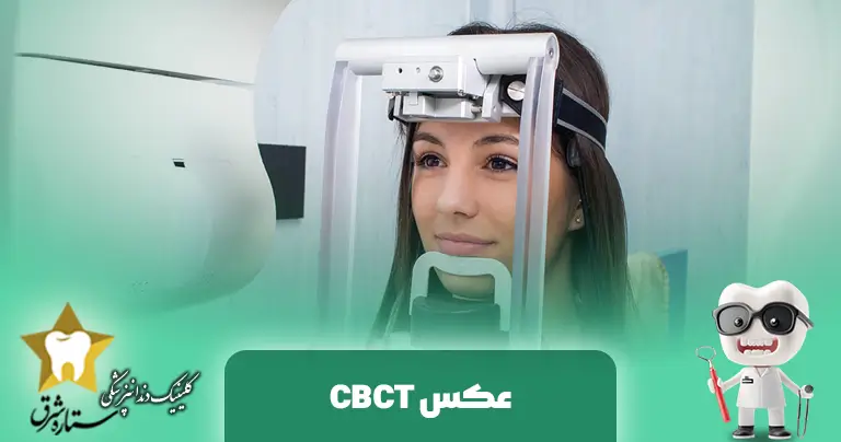 ما هي صورة CBCT؟ دليل شامل لتصوير الأسنان والفك ثلاثي الأبعاد