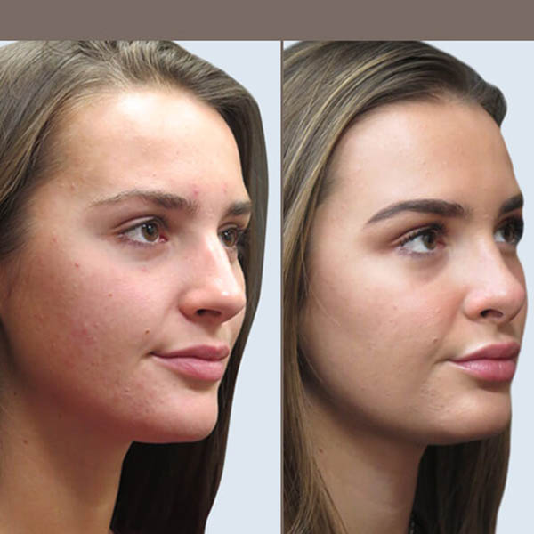 أفضل جراح أنف في طهران - الدكتور حميد رضا راستي