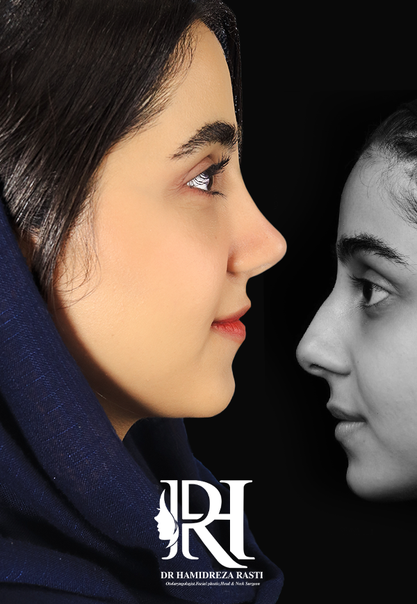 الجيل الجديد من جراحة البيزو: ثورة في جراحة الأنف - د. حميد رضا راستي