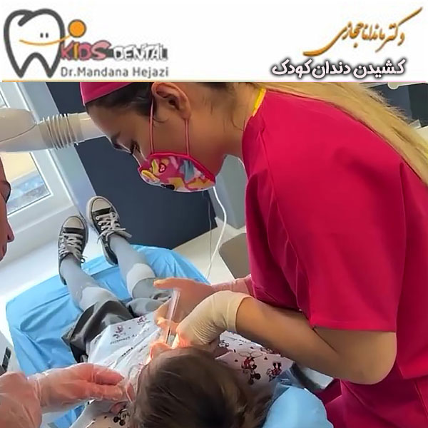 خلع اسنان طفل الدكتور مندانا حجازي في طهران