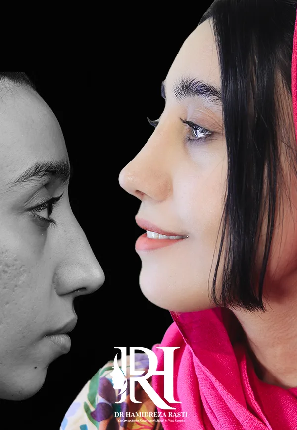 أفضل جراح تجميل الأنف في طهران - الدكتور حميد رضا راستي