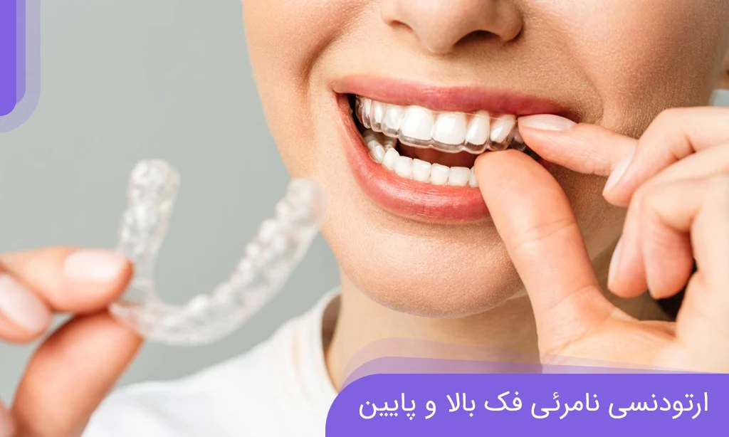 Invisible orthodontics for the upper and lower jaw | Dr. Khadavi