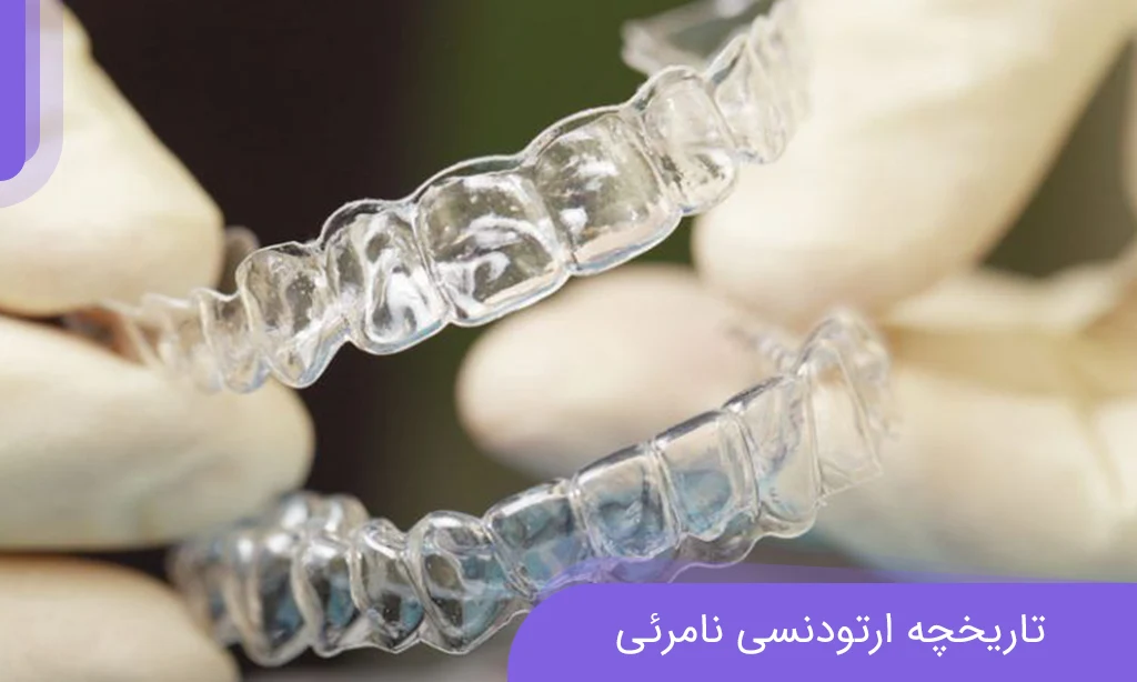 تاريخ تقويم الأسنان غير المرئي. تطور اللويحات التقويمية الشفافة | دكتور خاديفي