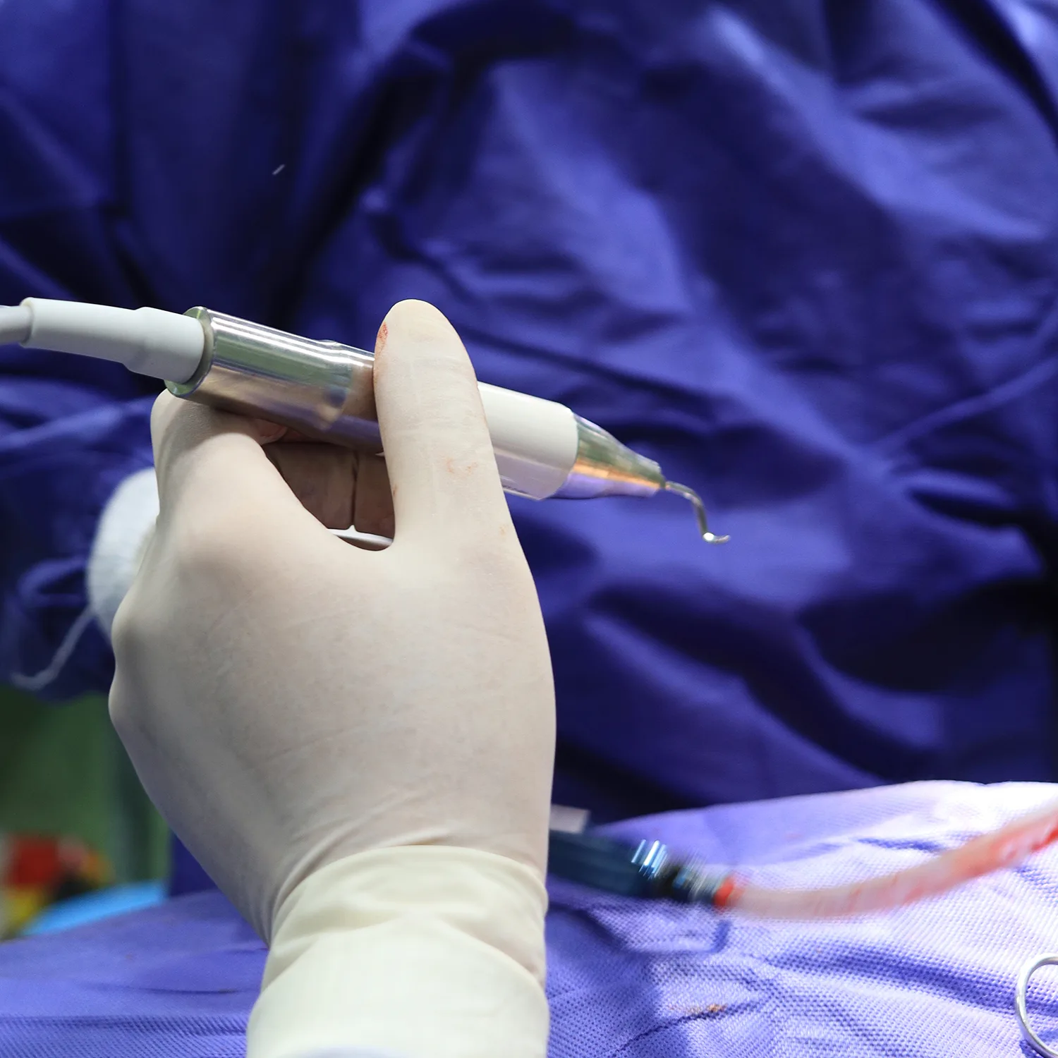 جراحة البيزو، أحدث طريقة لجراحة الأنف - د. حميد رضا راستي