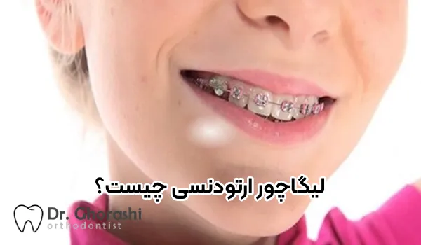 ما هو الرباط التقويمي وما هو استخدامه؟