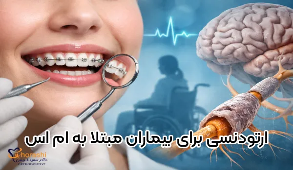 تقويم الأسنان لمرضى التصلب المتعدد ابتسامة جميلة أم كارثة كبيرة؟