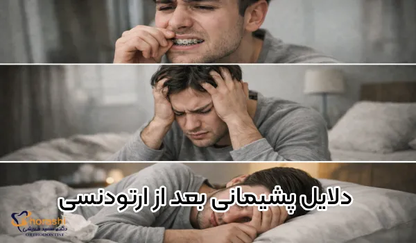 ما هو سبب الندم بعد تقويم الأسنان؟